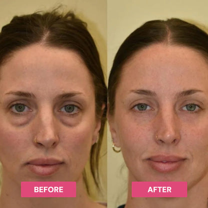Korean Pink Collagen Multi Balm