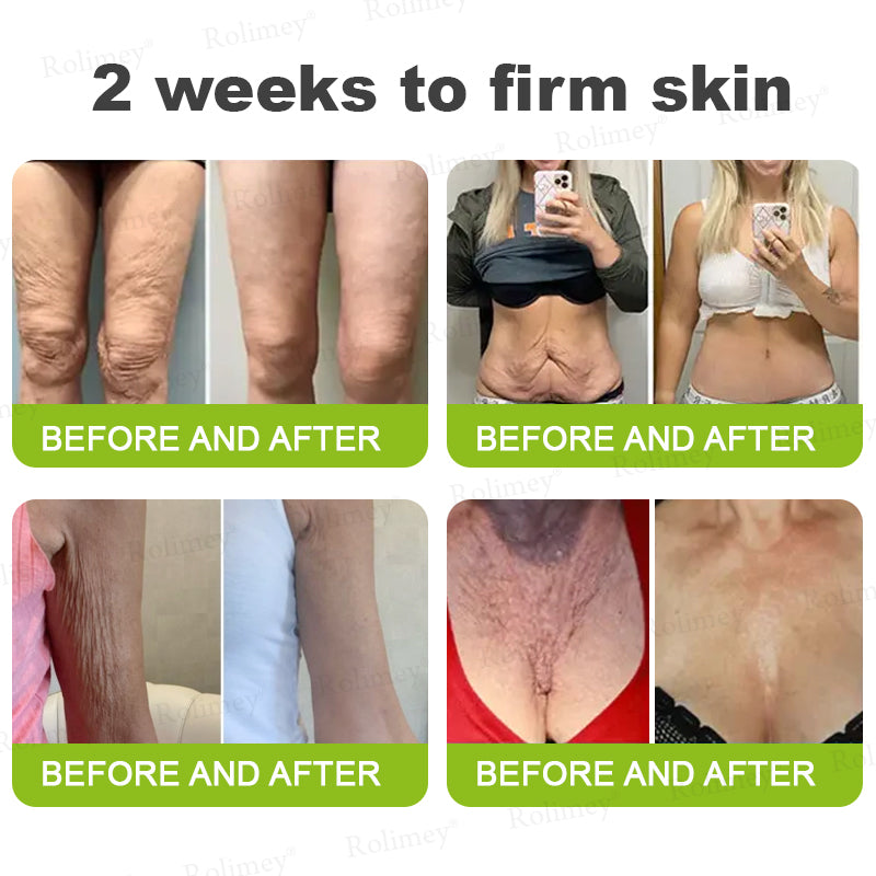 up-[🔥Last Day 70% OFF] ODALIT™ Botox & Retinol Shot - Eraser for Deep Wrinkles, Sagging Jowls & Puffy Eyes