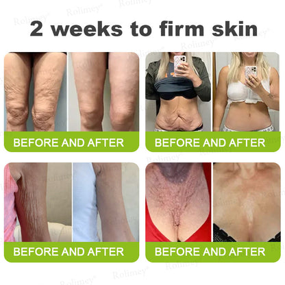 up-[🔥Last Day 70% OFF] ODALIT™ Botox & Retinol Shot - Eraser for Deep Wrinkles, Sagging Jowls & Puffy Eyes