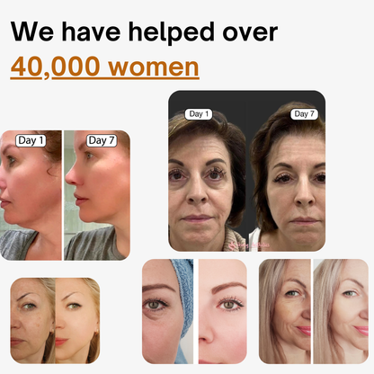 up-ODALIT™ Lymphatic Face Brush — Instantly Reduce Puffiness & Sculpt Your Jawline