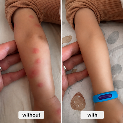 Mosquito Bracelet