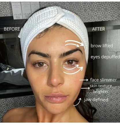 up-ODALIT™ Lymphatic Face Brush — Instantly Reduce Puffiness & Sculpt Your Jawline