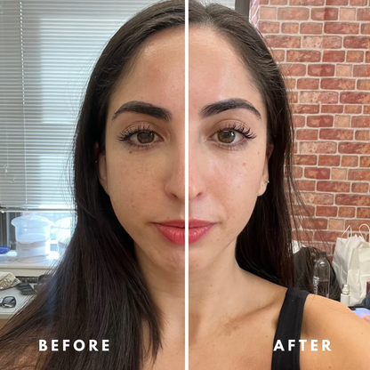 up-ODALIT™ Lymphatic Face Brush — Instantly Reduce Puffiness & Sculpt Your Jawline